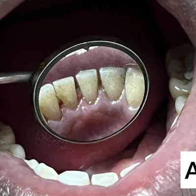 General Dentistry After Case Study