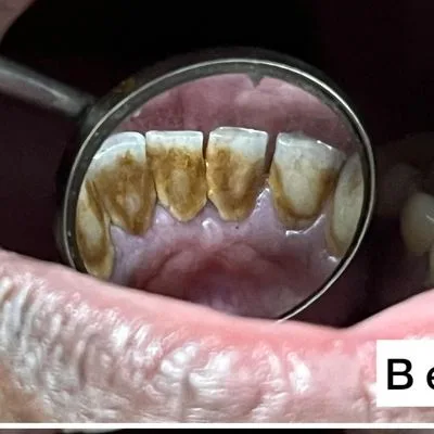 General Dentistry Before Case Study
