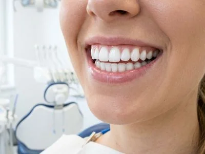 Teeth Whitening